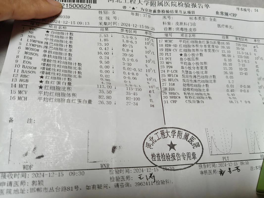 疾控中心水痘病例处置报告：隔离、接种、停课等要求全知道